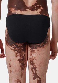 Costumi da bagno neri indossati in vita, in contrasto con la pelle che presenta modelli di pigmentazione chiara e scura. Texture morbida e vestibilità aderente.