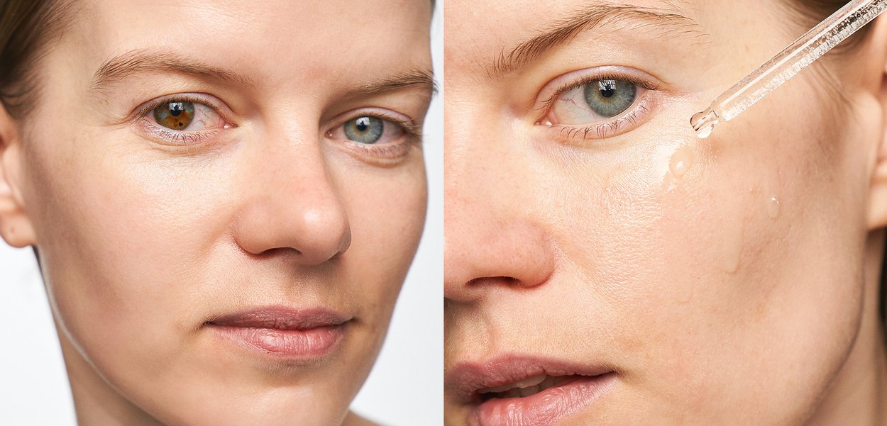 Close-up of a face showing even skin tone and fine texture. The right side features a dropper applying clear serum to the skin.