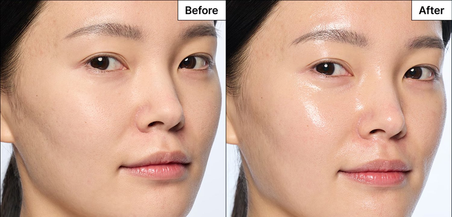 Visage de femme avant et après un traitement de soin de la peau montrant une peau plus lisse, plus éclatante, avec une diminution de la ternissure et une meilleure hydratation.