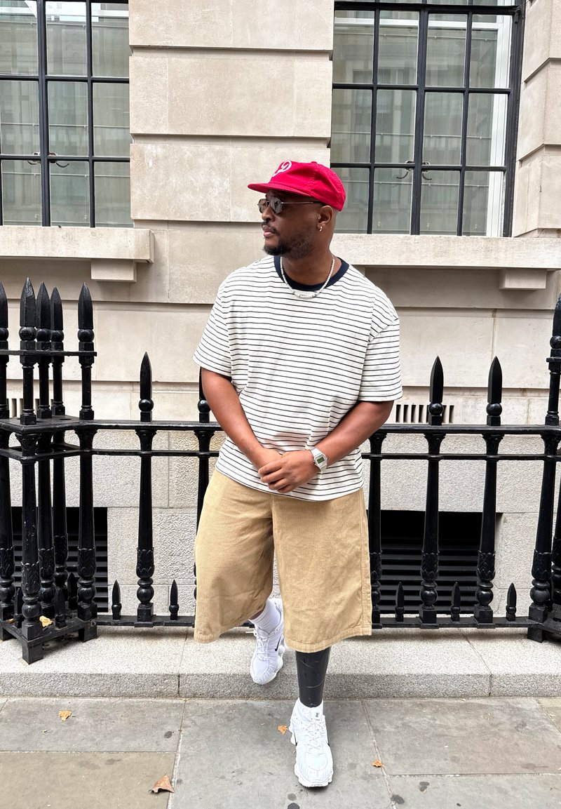 Homme portant une casquette rouge, une chemise à rayures et un short beige, debout sur une jambe prothétique près d'une clôture en fer noire devant un bâtiment en pierre.