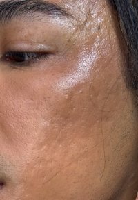 Close-up van huid met een glad oppervlak en zichtbare poriën, met een glanzende textuur en subtiele kleur- en toonvariaties.