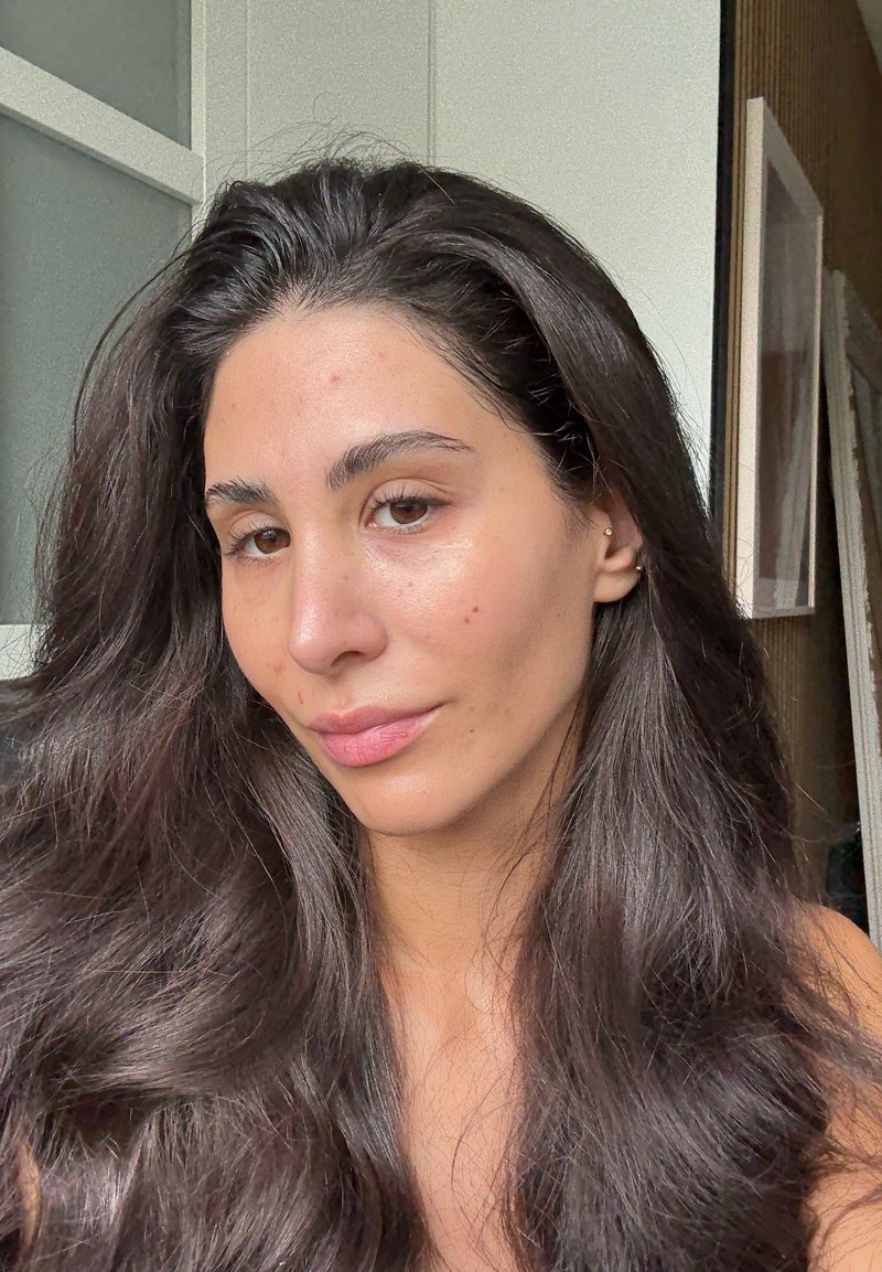Portrait of a person with long, dark brown hair, light skin, and subtle acne. The background is neutral with soft lighting.