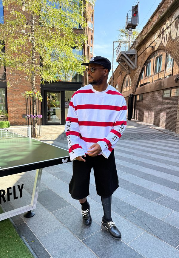 Homme portant une chemise blanche à rayures rouges, un short noir et une jambe prothétique, debout à côté d'une table de ping-pong en plein air.