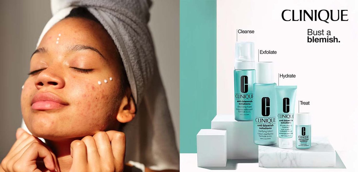 Clinique skincare products displayed: light blue containers and tubes on white surfaces. A person with a towel on their head has dots of cream on their face.